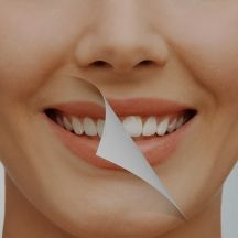 Slider image (2) Bio M Dental